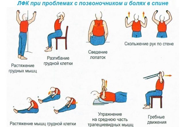Лечебная физкультура для позвоночника ЛФК при проблемах с позвоночником и болях в спине