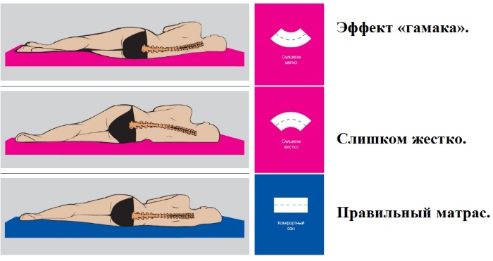Болит спина в области поясницы. Чем лечить, если отдает в ногу. Причины, уколы, мази, народные средства