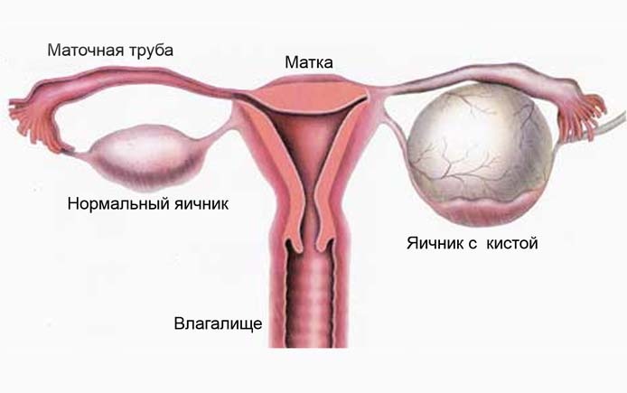 Перед и после месячных болит спина