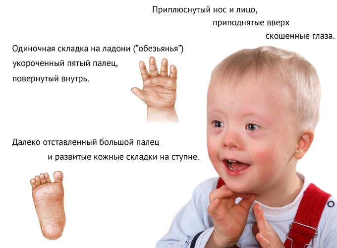 Лууле Виилма. Причины болезней, аффирмации. Заболевания позвоночника и суставов, пищеварительной, нервной системы, псориаз