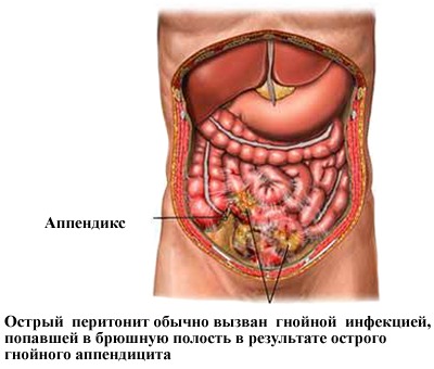 Перед и после месячных болит спина